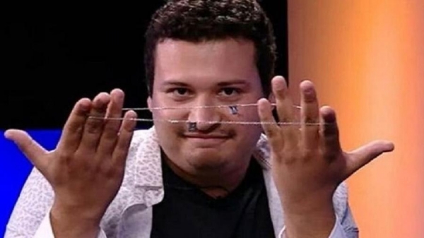 Ex-BBB Victor Hugo é transferido para a UTI; Flay e Ivy pedem orações