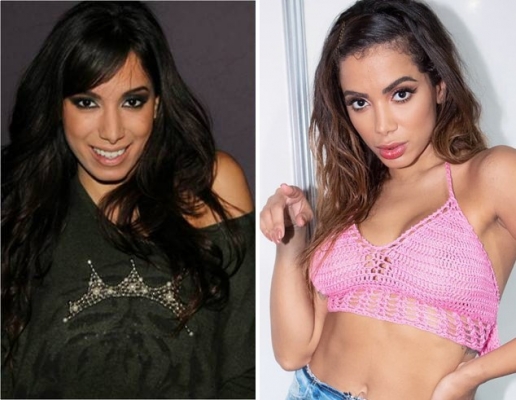Anitta quase entrou em depressão após gastar R$ 20 mil em plásticas, diz livro