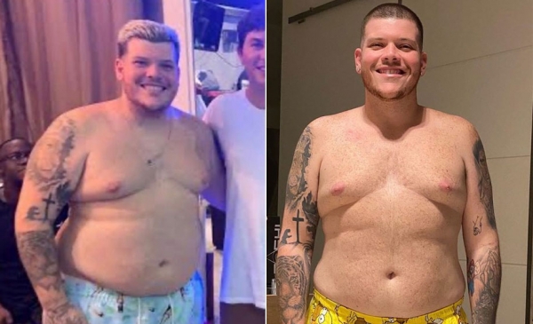 Ferrugem emagrece 33 kg e choca fãs com “antes e depois”